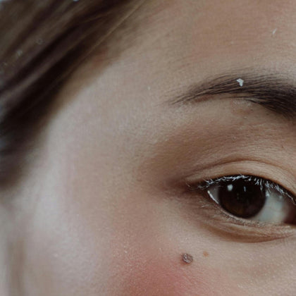 5 Natural Skincare Steps for Healthy, Glowing Winter Skin